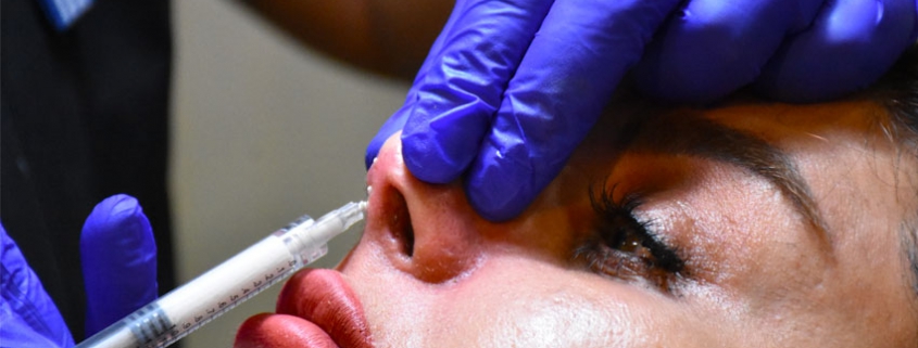 کوچک کردن بینی بدون جراحی با تزریق آنزیم