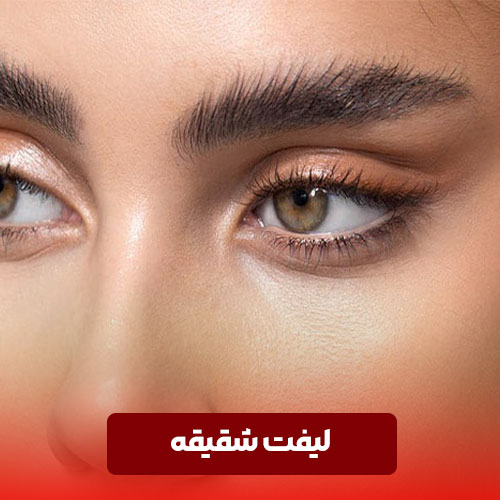 جراحی لیفت شقیقه