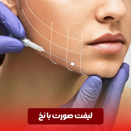 لیفت صورت با نخ