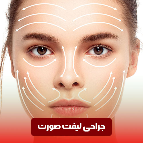 جراحی لیفت صورت