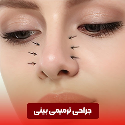 جراحی ترمیمی بینی