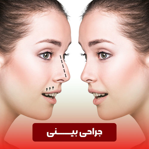 جراحی باز و بسته بینی